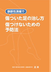 静脈性潰瘍で傷ついた足の治し方 傷つけないための予防法